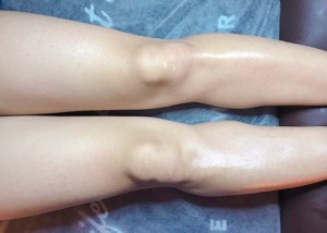 脚 スネ毛 のワックス脱毛 メリット 注意点と施術動画をご紹介 Nadio